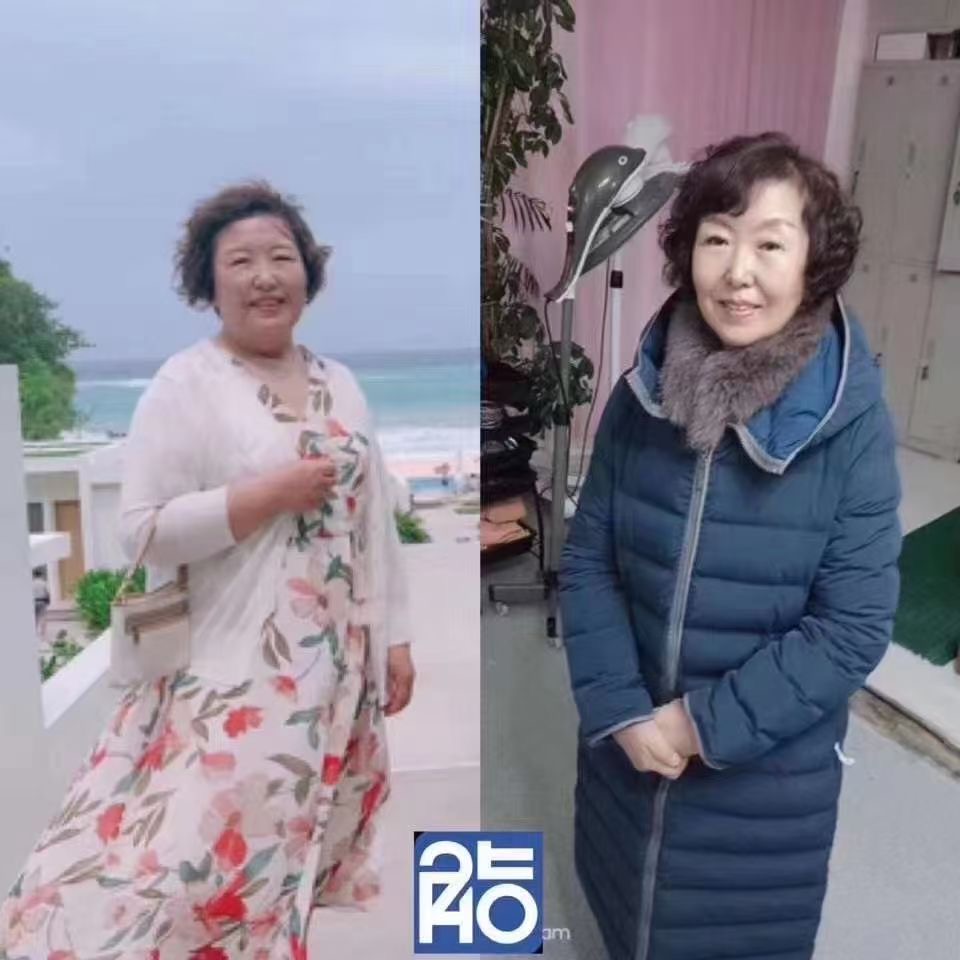 瘦了29斤的金阿姨，你猜她多少岁了？