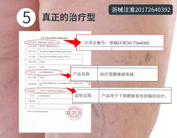 【派菲特】2级压力治疗型静脉曲张袜长筒开口款