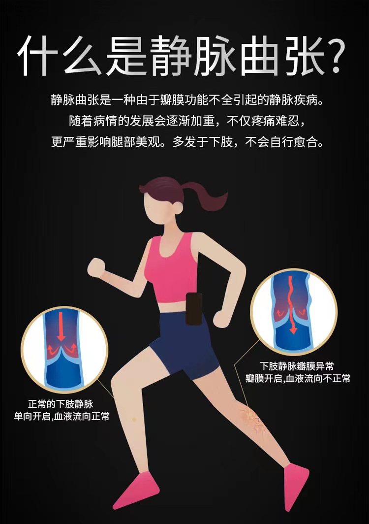 【派菲特】1级压力治疗型静脉曲张袜长筒直筒款