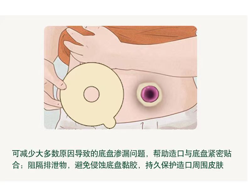 【思泰利】防漏圈/防漏环4MM