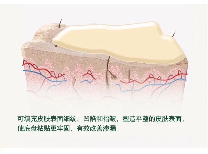 【思泰利】防漏圈/防漏环4MM