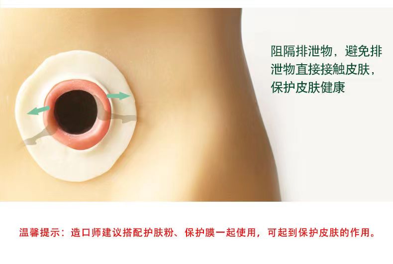 【思泰利】防漏圈/防漏环4MM