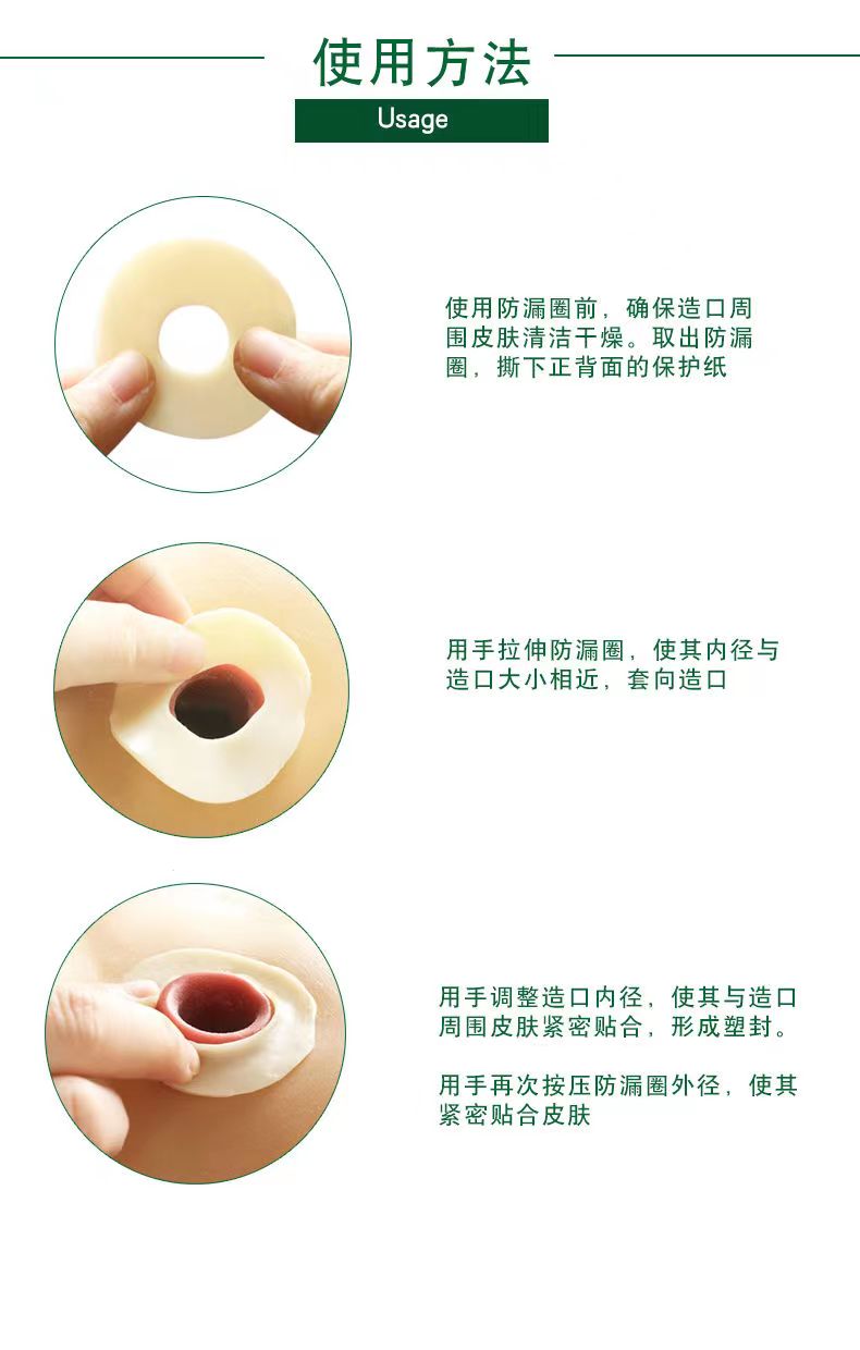 【思泰利】防漏圈/防漏环4MM