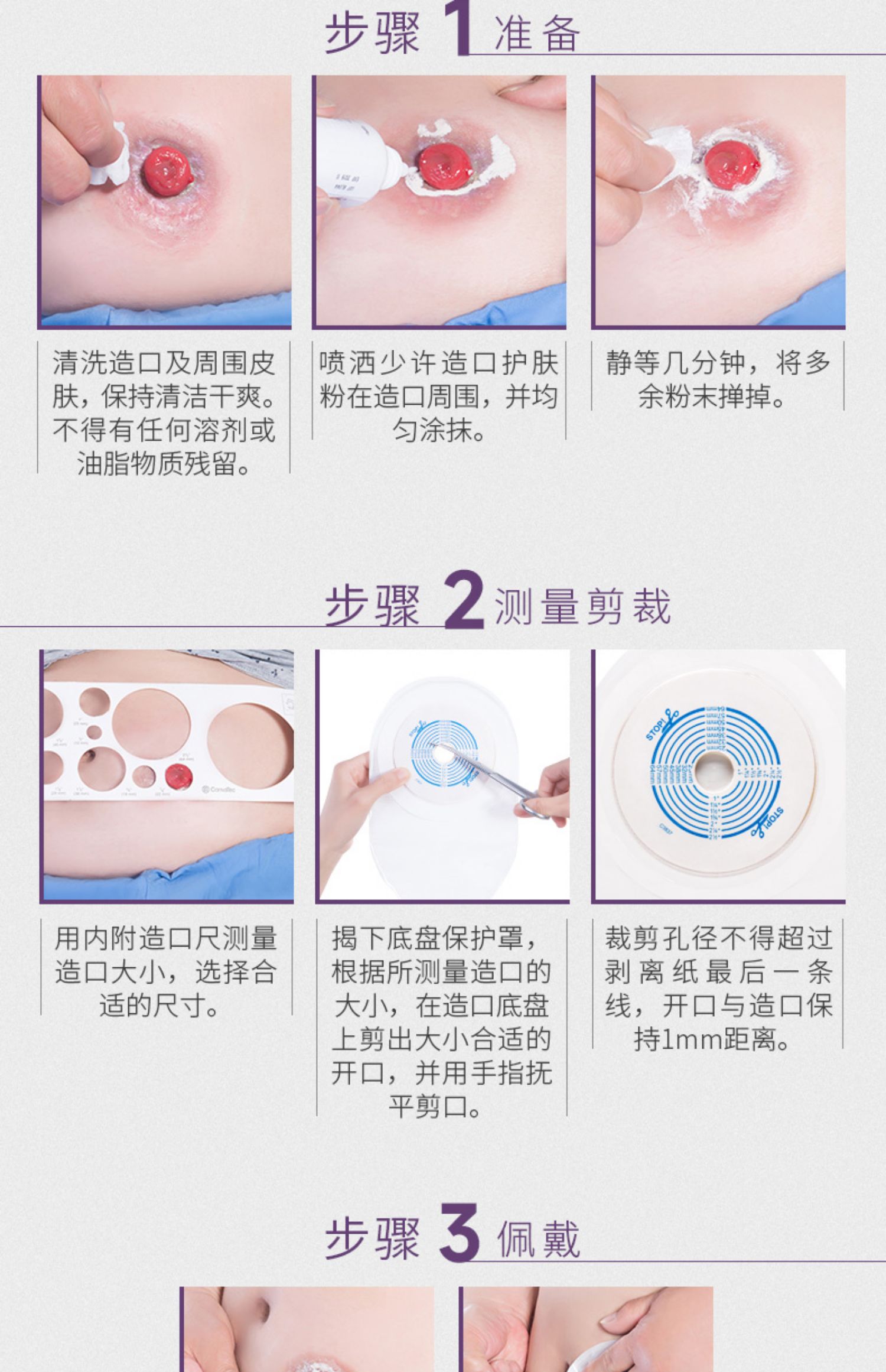 康维德一件式造口袋22771