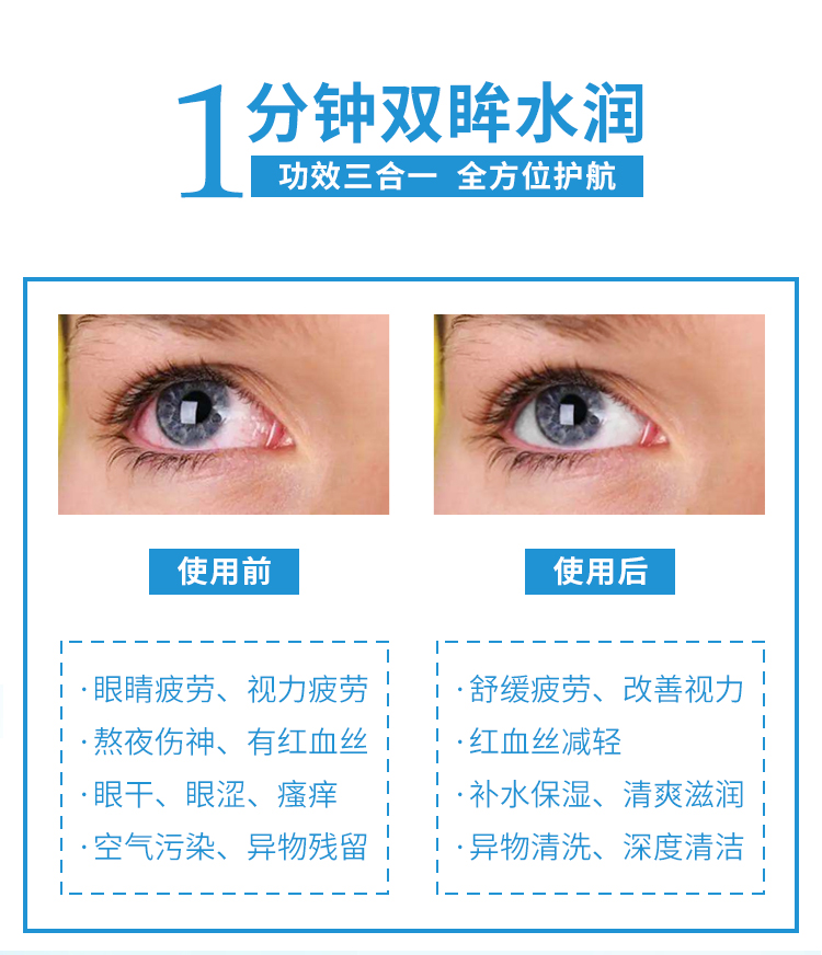 小心眼雾化洗眼液90ml 清洁眼睛清洗滋养水润眼部护理喷雾