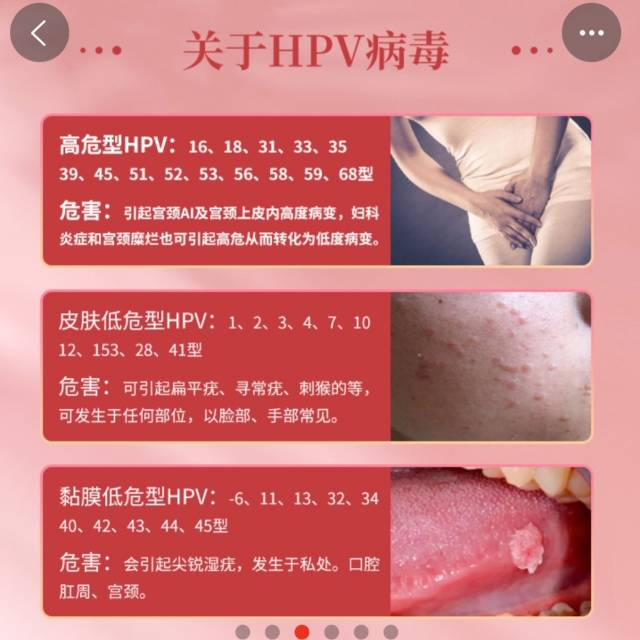 可容科技玉坤舒抑菌片滋养排毒预防HPV，公司有销售模式（请在线下实体店购买）