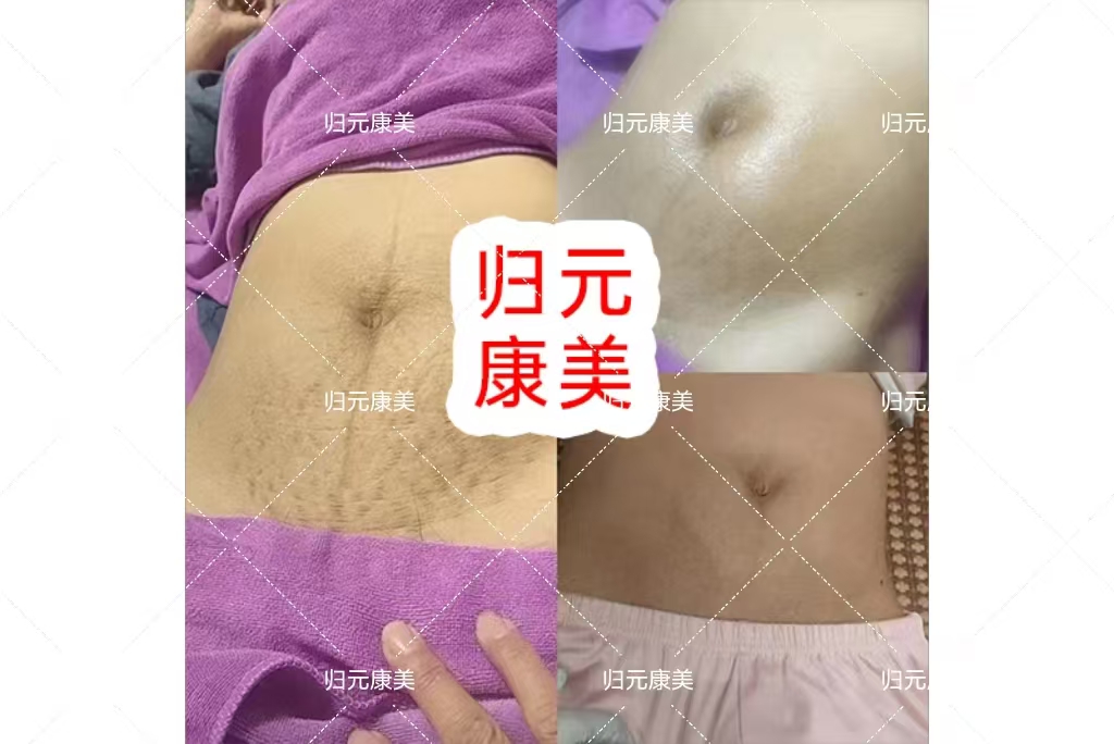 生活艺术家×羌活植物凝胶