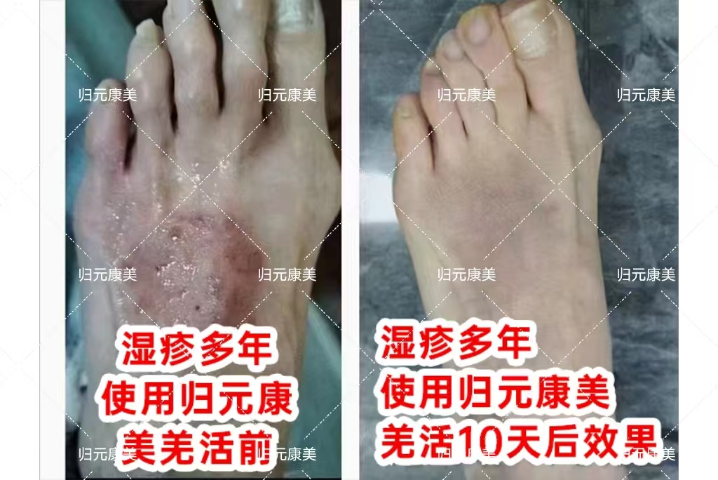 生活艺术家×羌活植物凝胶