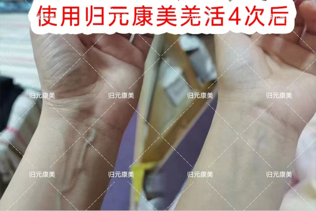 生活艺术家×羌活植物凝胶