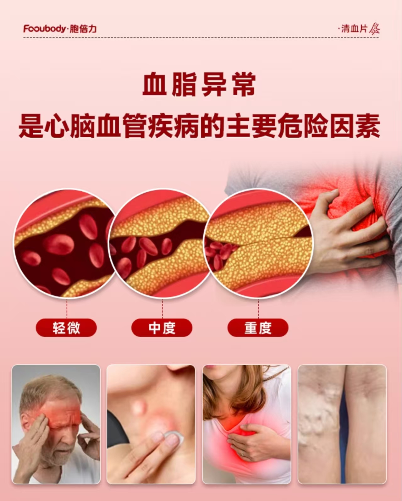 清血片.血管软黄金